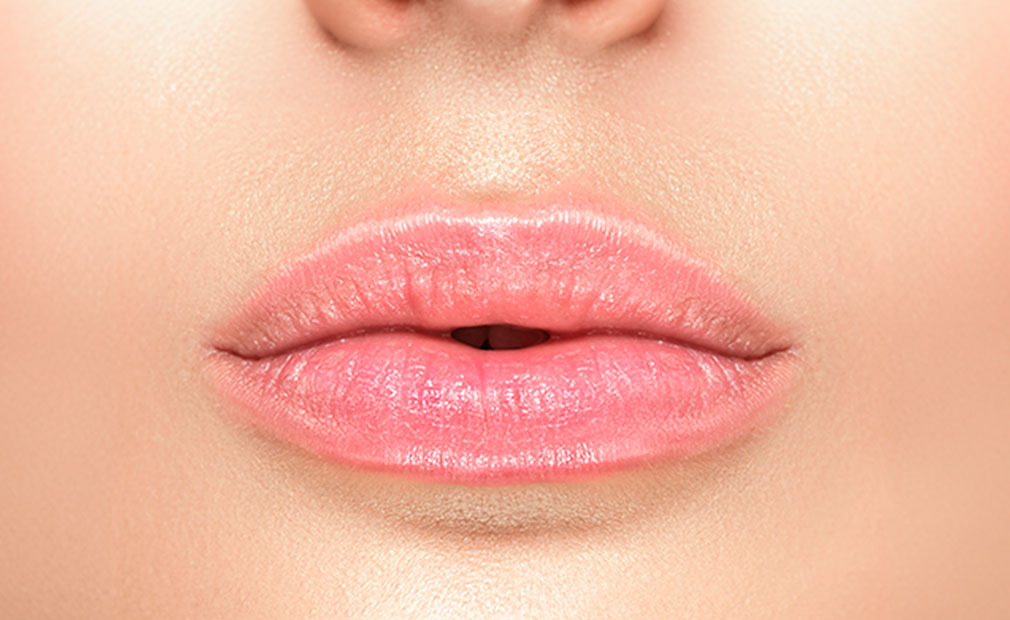 Preenchimento Labial